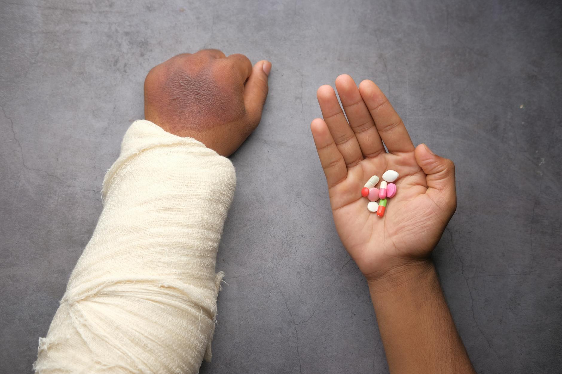 A close-up of an injured arm with a bandage and various pills on a gray background.