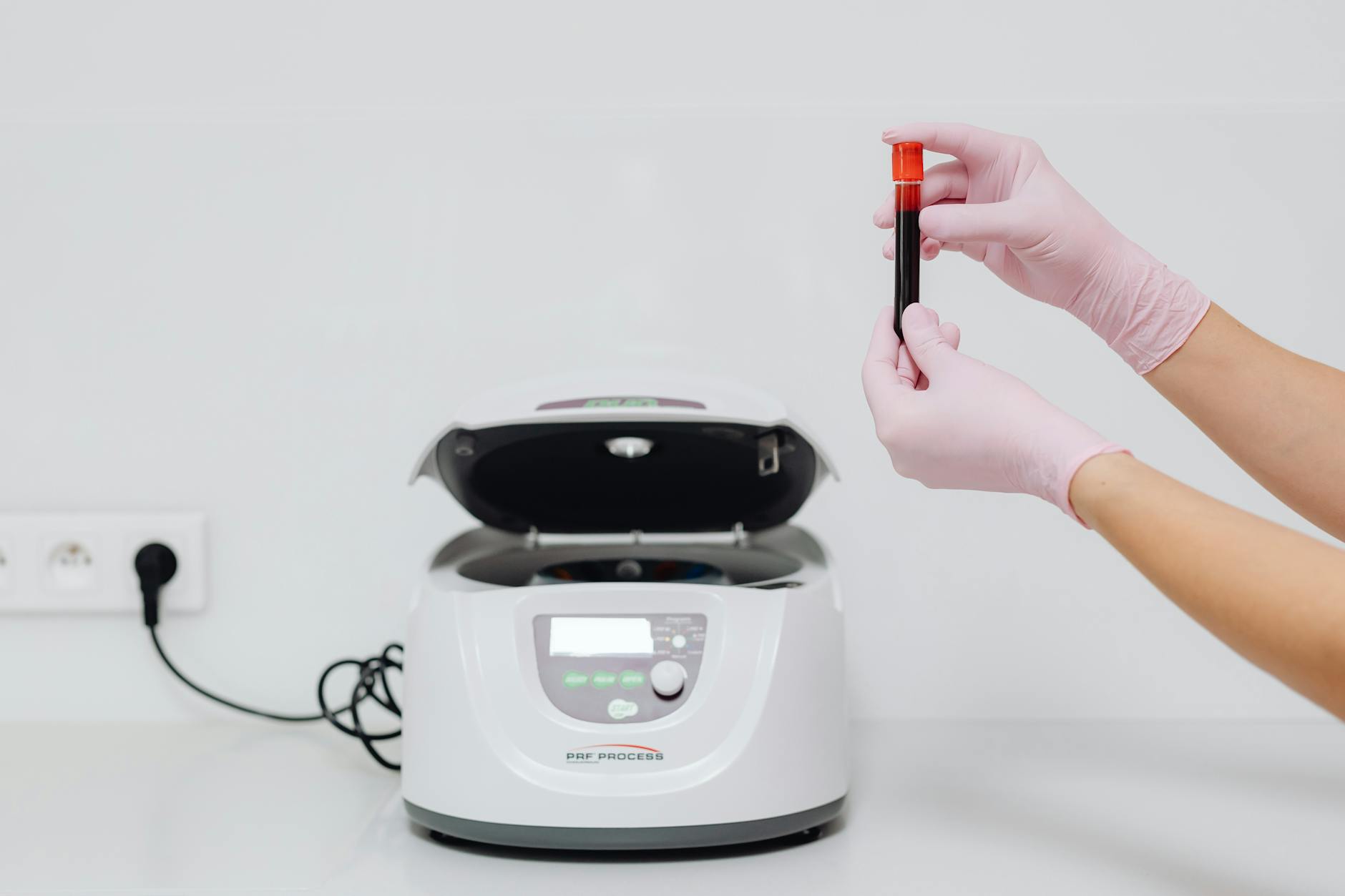 10 Common Liver Function Test Markers Everyone Should Understand