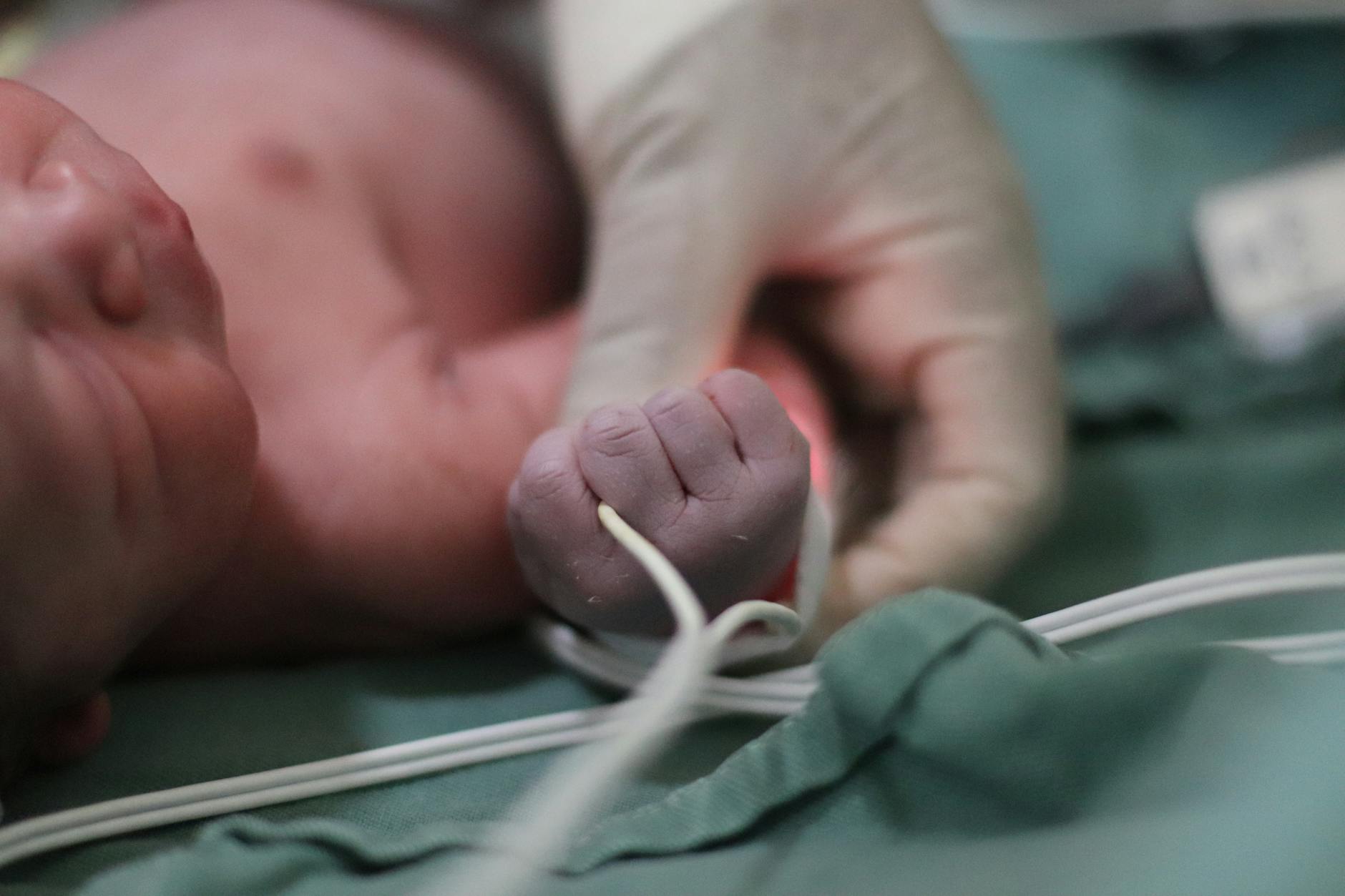 10 Proven Jaundice Treatments and How They Actually Work