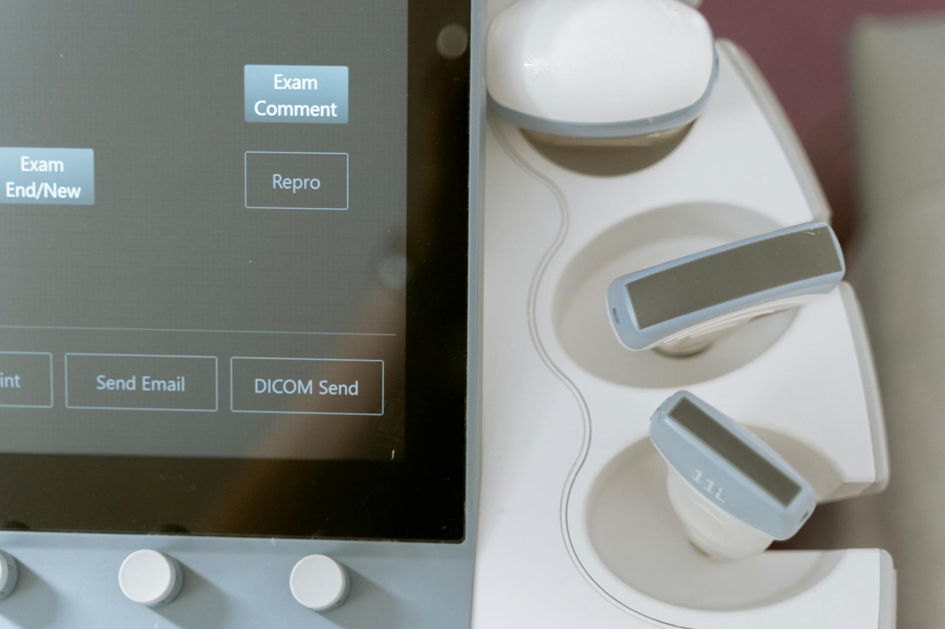 10 Known Realities of Molar Pregnancy