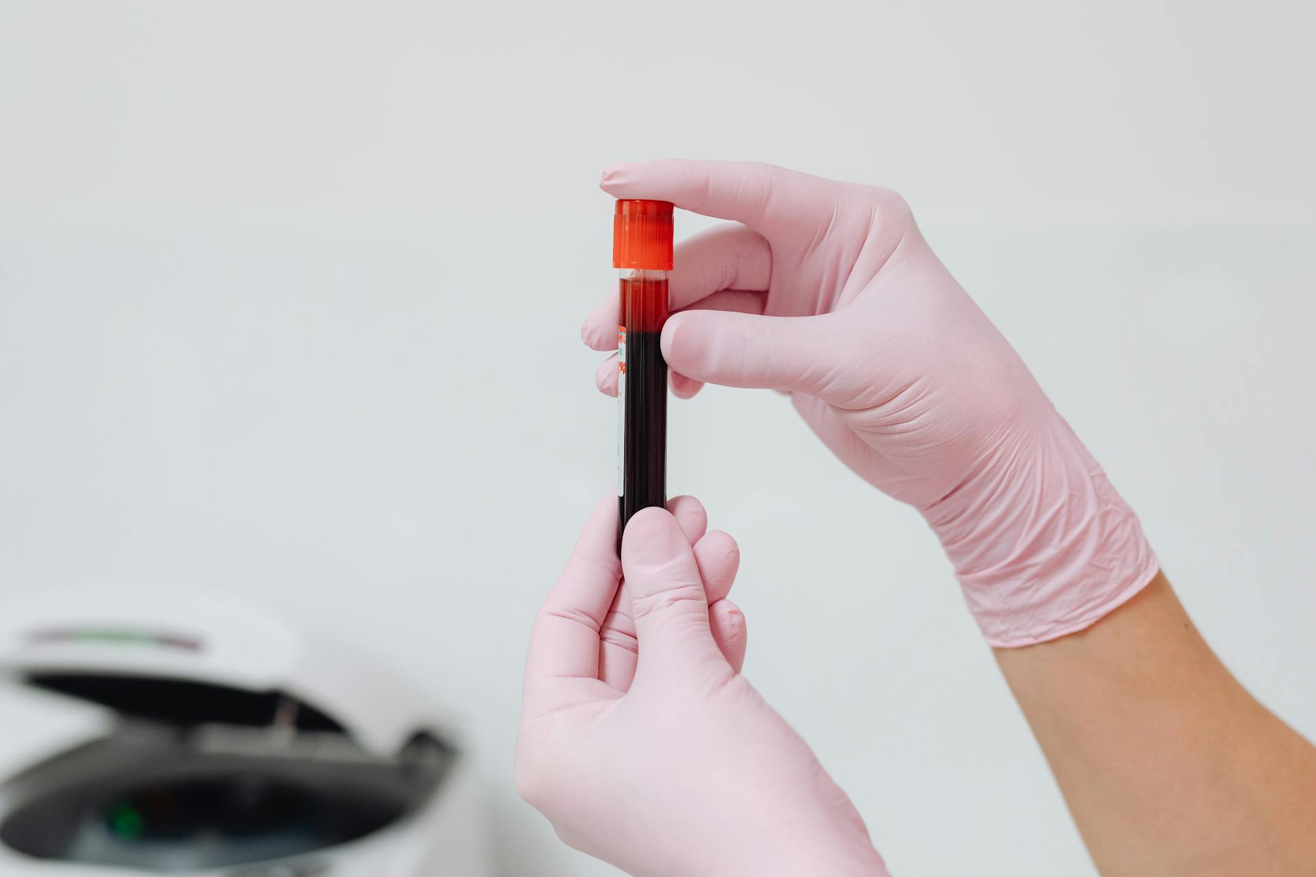 10 Common Liver Enzyme Test Facts Everyone Should Know
