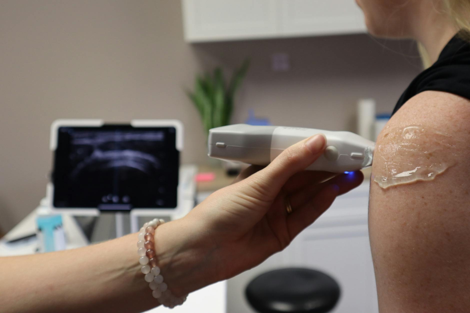 10 Common Medial Collateral Ligament Facts Everyone Should Know