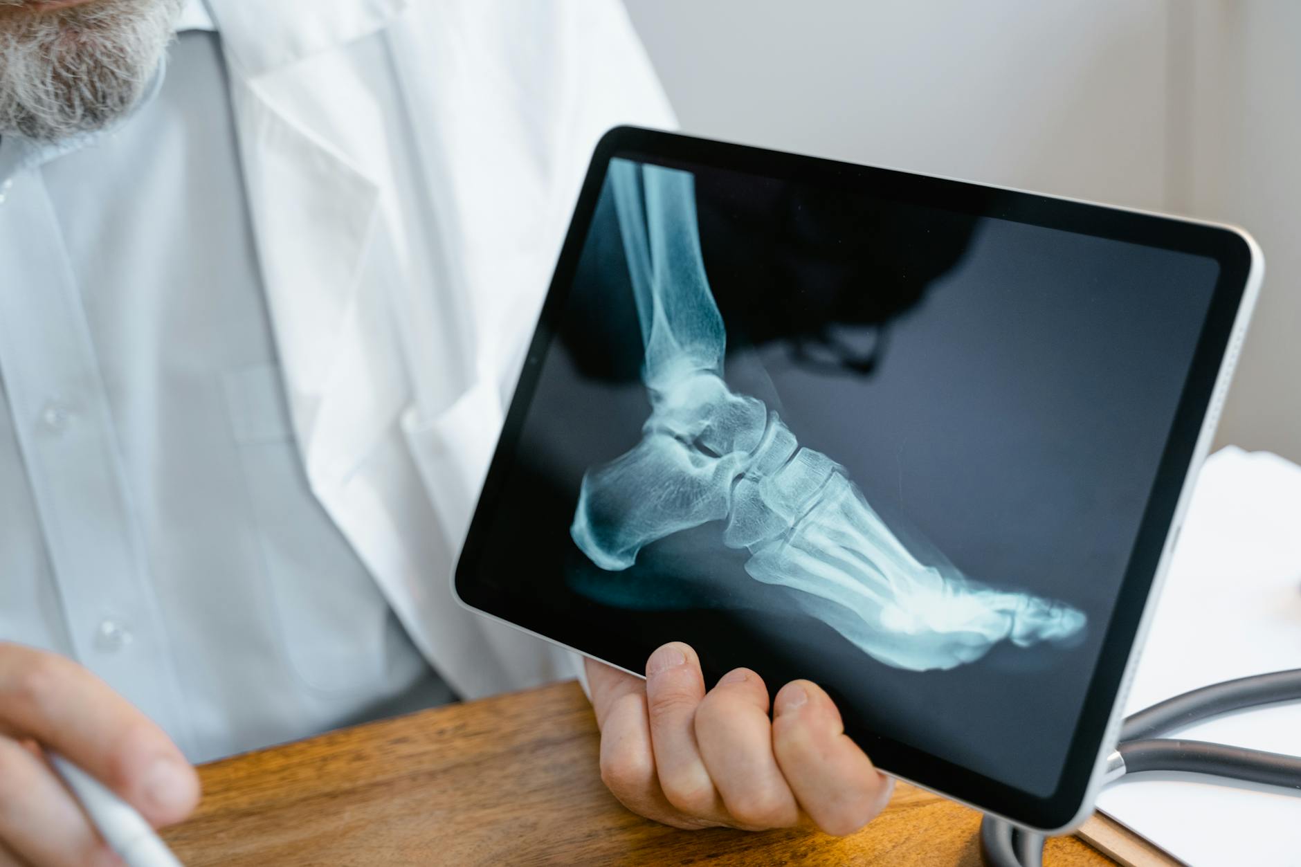 10 Surprising Facts About the Fibula Bone You Should Know