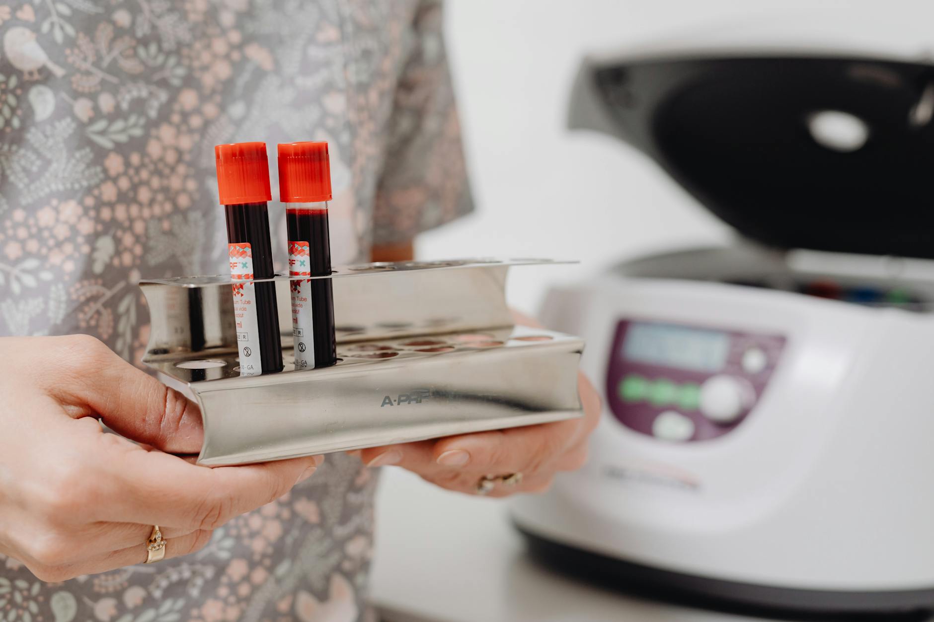Close-up of blood vials in a laboratory setting, ready for testing.