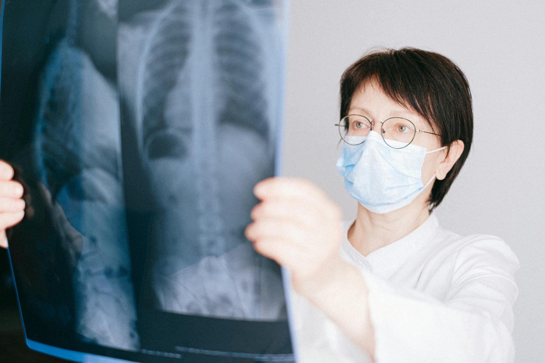 10 Surprising Truths About Your Lung Anatomy