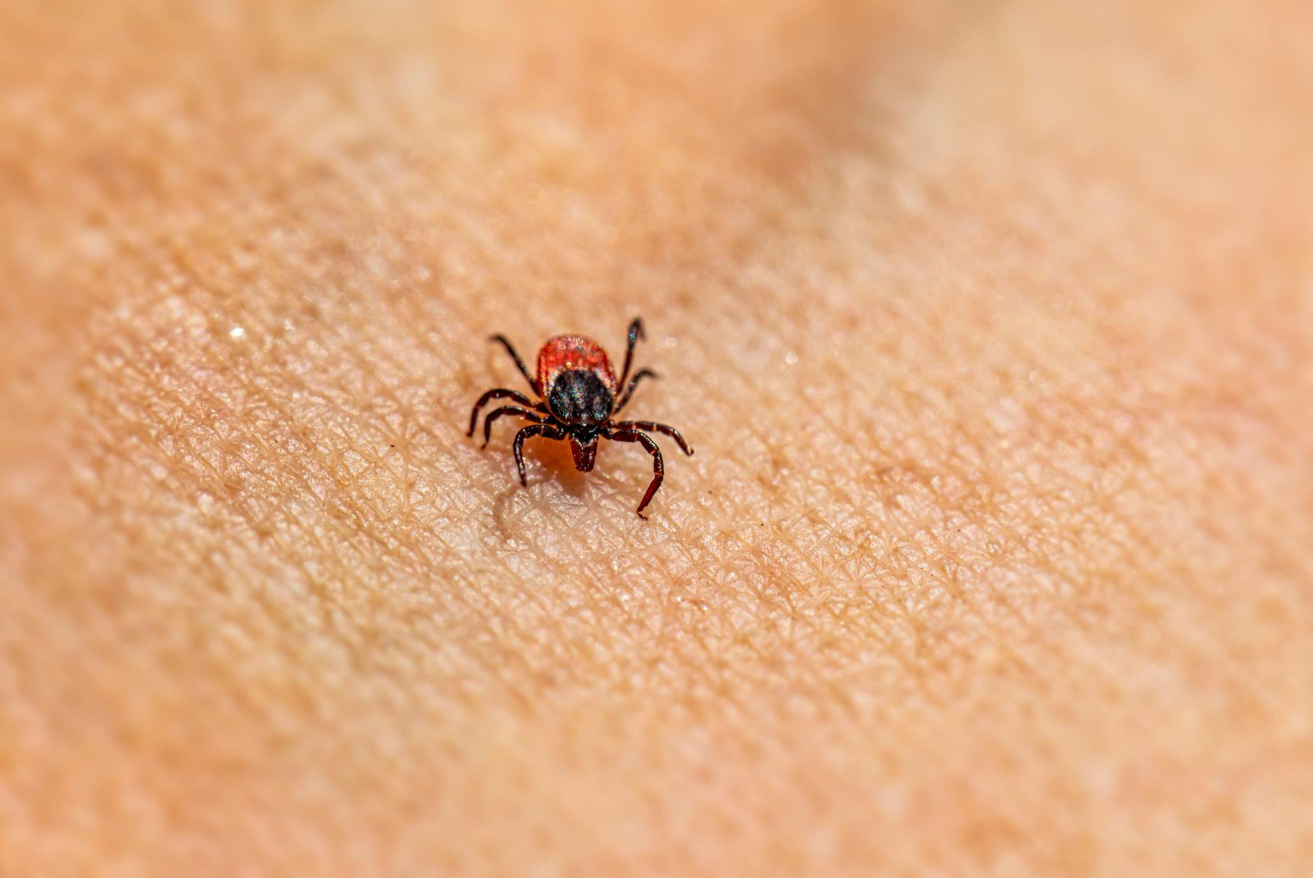 10 Surprising Truths About the Lyme Disease Rash
